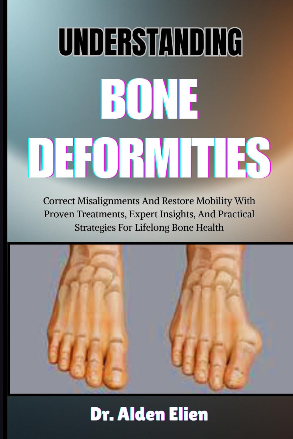 UNDERSTANDING BONE DEFORMITIES: Correct Misalignments And Restore Mobility With Proven Treatments, Expert Insights, And Practical Strategies For Lifelong Bone Health