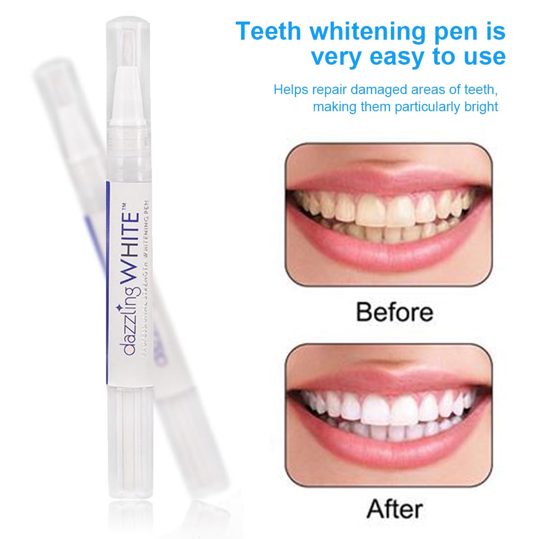 2 Pezzi Penna Sbiancante Denti, Penna Sbiancante per Denti, Sbiancamento rapido&Efficacia, delicato e paradenti per Denti Bianchi, Rimuove le Macchie Dentali