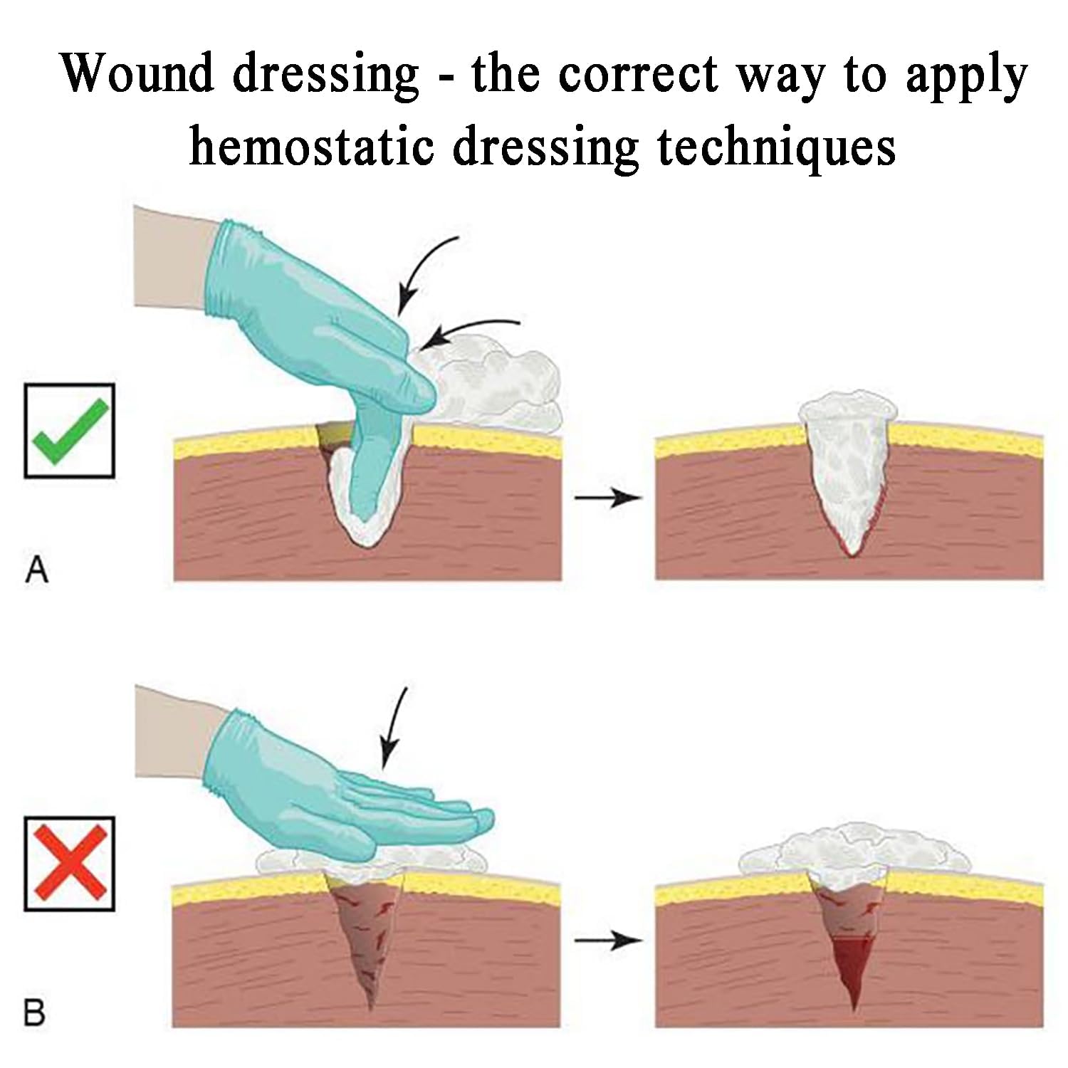 Simula Envoltura De Heridas Y Entrenador De Torniquetes, Modelos De Heridas Para El Cuidado De Heridas, Entrenador De Torniquetes Para Control De Sangre, Para Capacitación En Primeros Auxilios