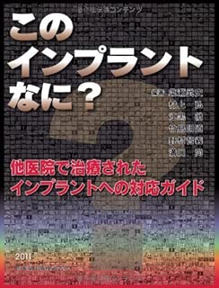 このインプラントなに?他医院で治療されたインプラントへの対応ガイド
