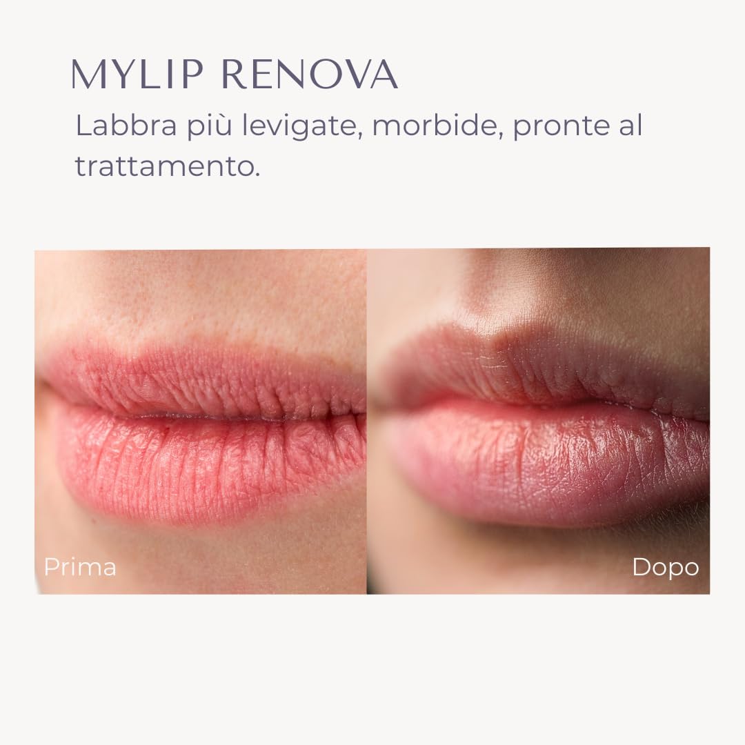 MyLip Renova Gentle Smoothing Lip Scrub MyRoutine by Dr. Maurizia Furno, 15 ml (Pack of 1) - Image 4