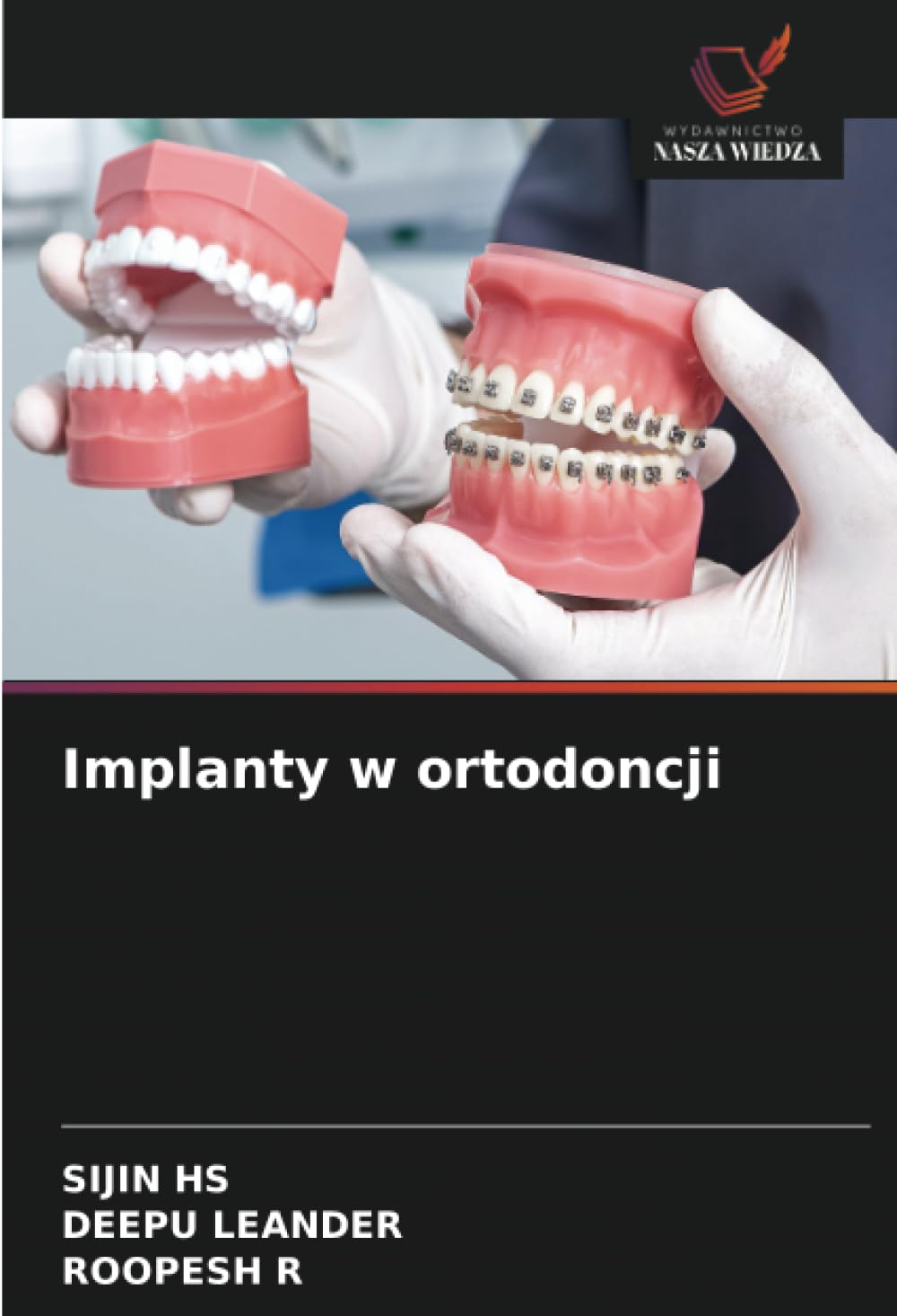 Implanty w ortodoncji