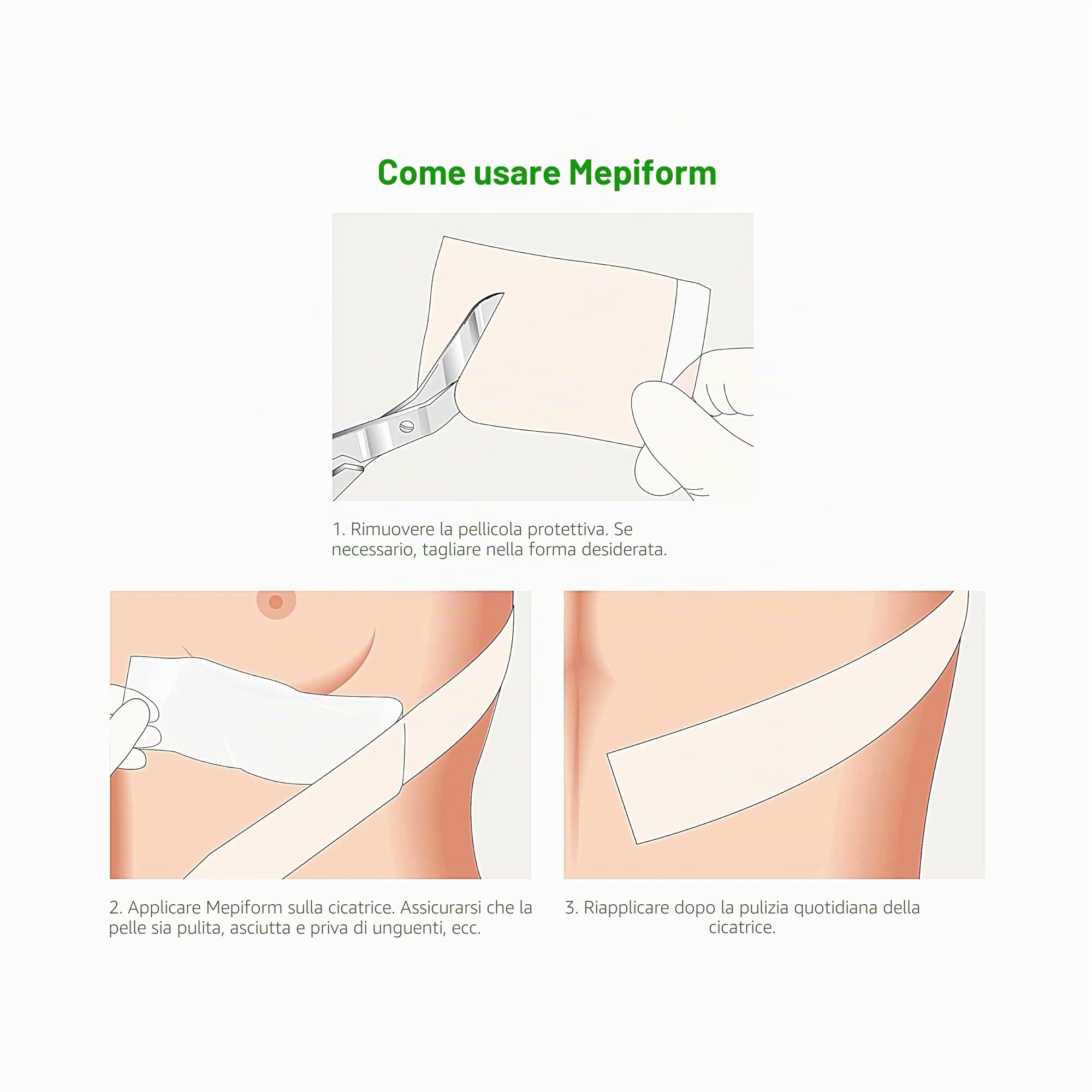 MEPIFORM Medicazione adesiva 10 x 18 cm Sterile Pack 5