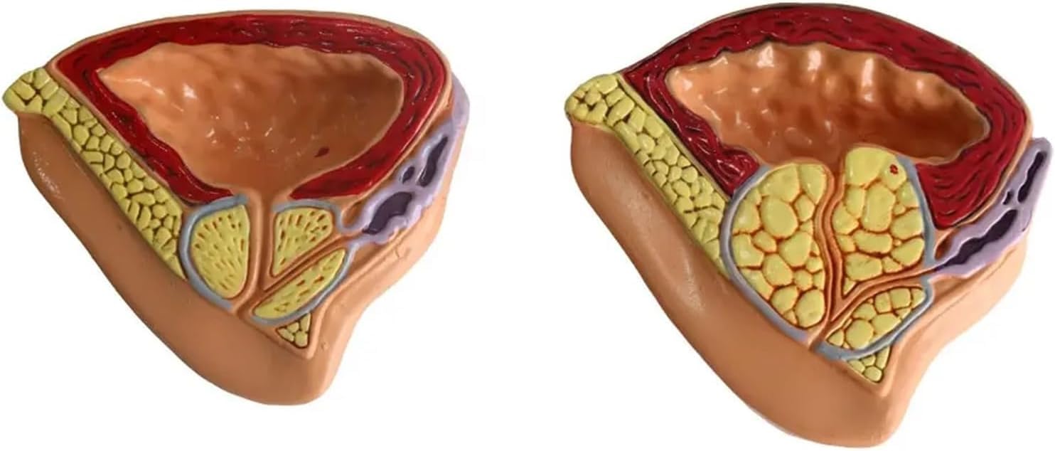 Generico Modello Anatomico del Sistema Riproduttivo Maschile, Modello Anatomico Patologico della Vescica della cavità Addominale Medica per Lo Studio Dell'educazione