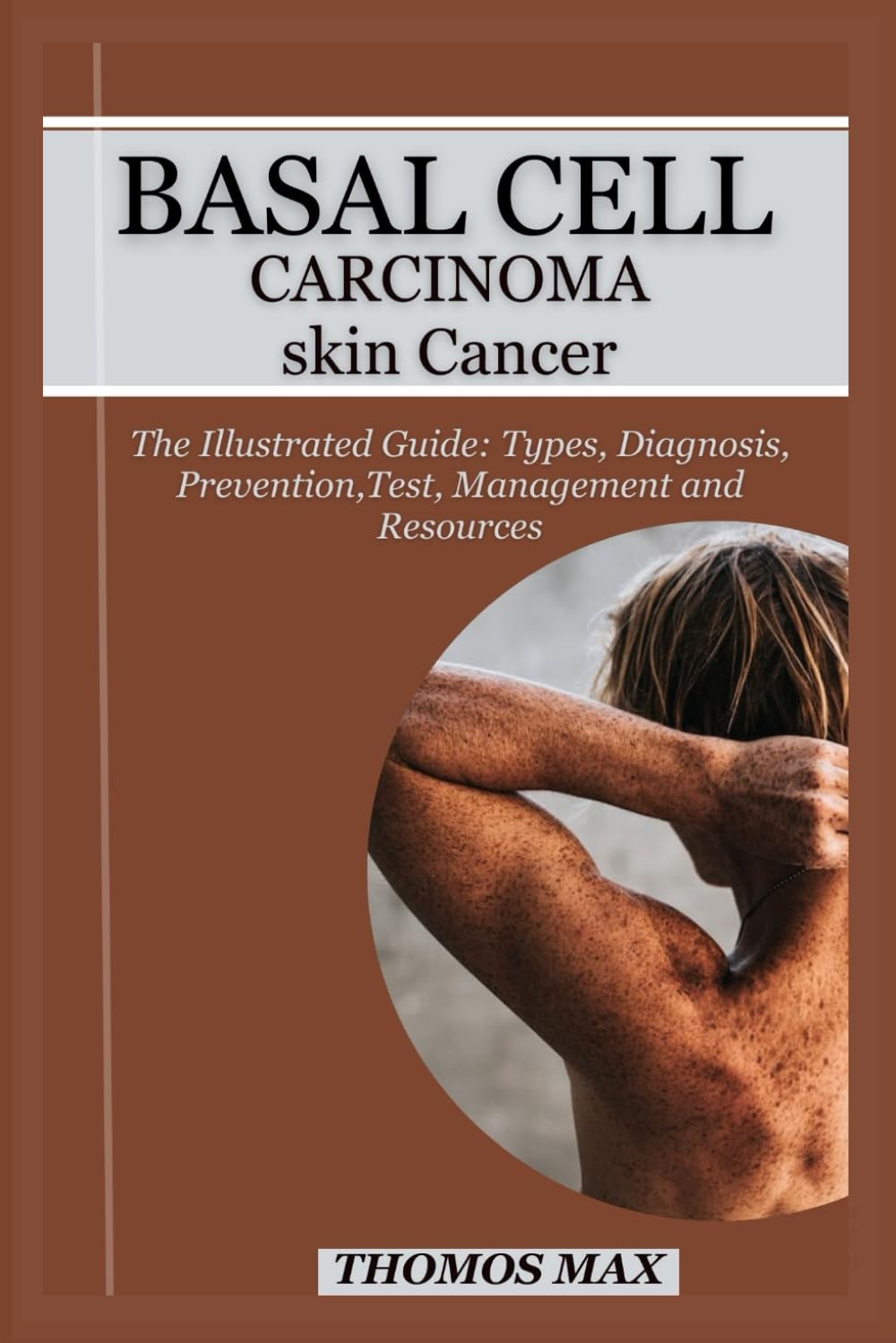 BASAL CELL CARCINOMA SKIN CANCER: The Illustrated Guide: Types, Diagnosis, Prevention, Test, Management, Resources And Questions to ask your doctors.