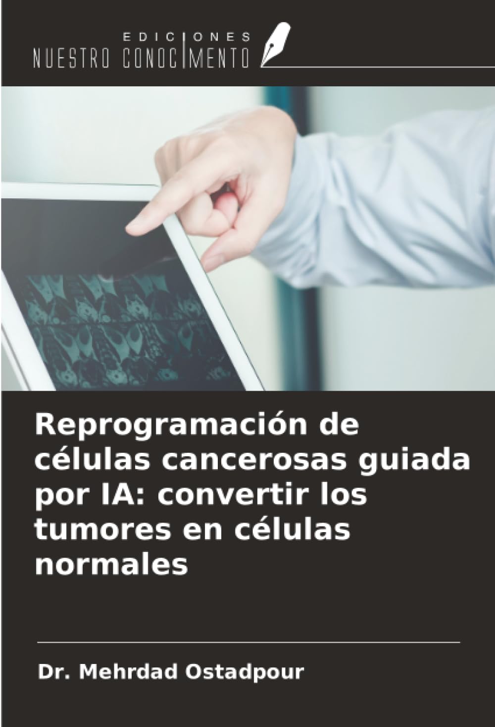 Reprogramación de células cancerosas guiada por IA: convertir los tumores en células normales