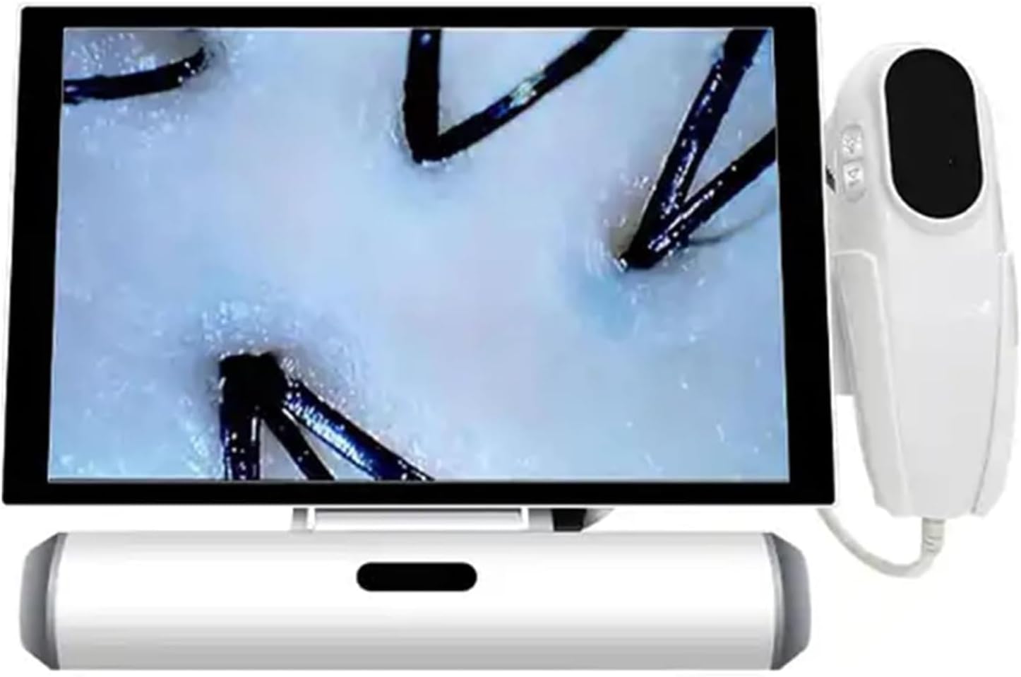 Scalp Hair Follicle Detector Machine, 11 Inch Skin Diagnosis Hair Analyzer, 4 Spectral Detection 10 Million Pixels 50X 200X Dual Lens Switch at Will for Home Beauty Salon Spa