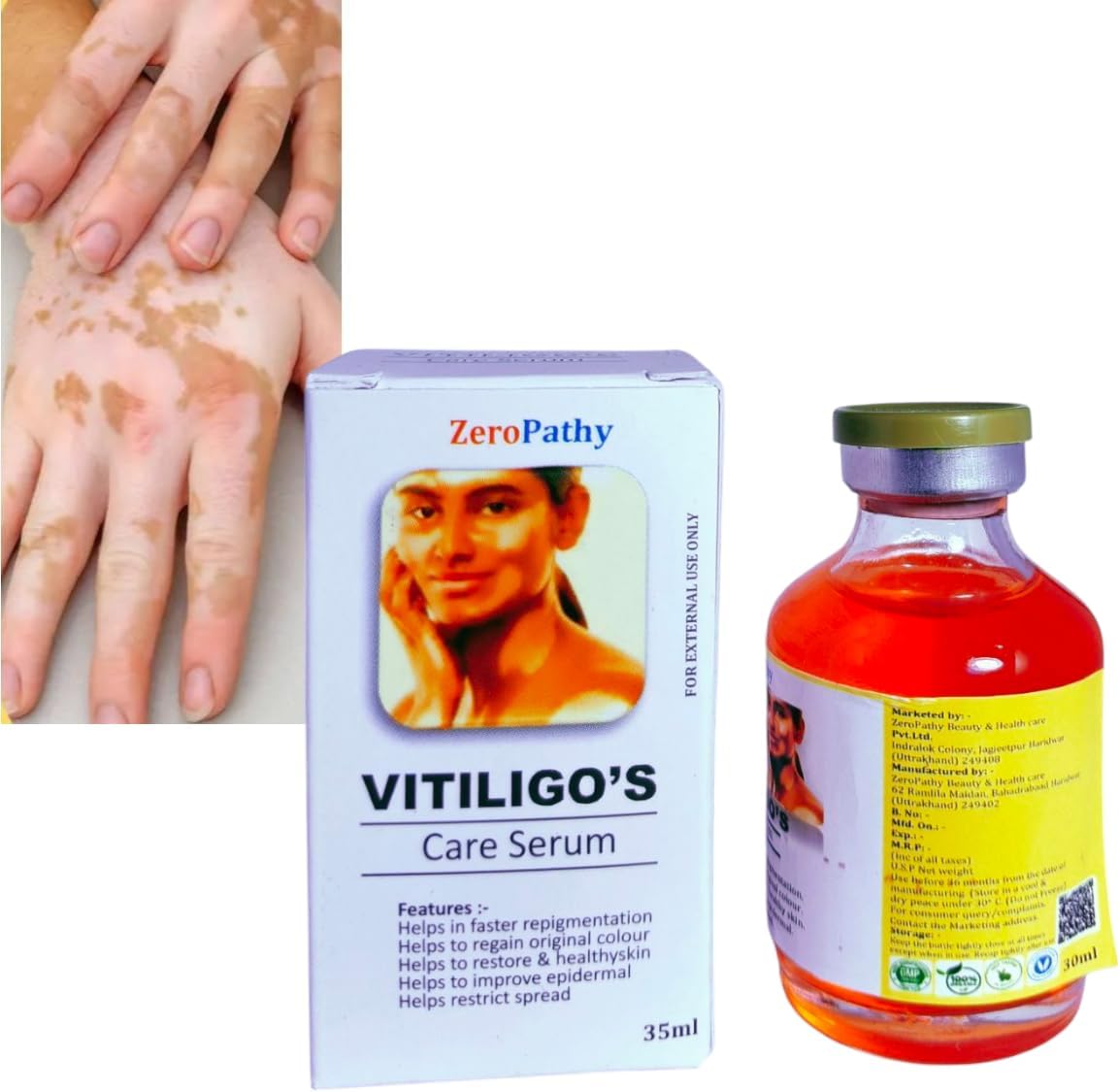 White Spot Ointment,Safed Daag Ke Liye,Natural Vitiligo with Turmeric, Aloe Vera & Ginseng, Designed to Restore Skin Pigmentation,Moisturing Disease Treatments Tag Remove Serum