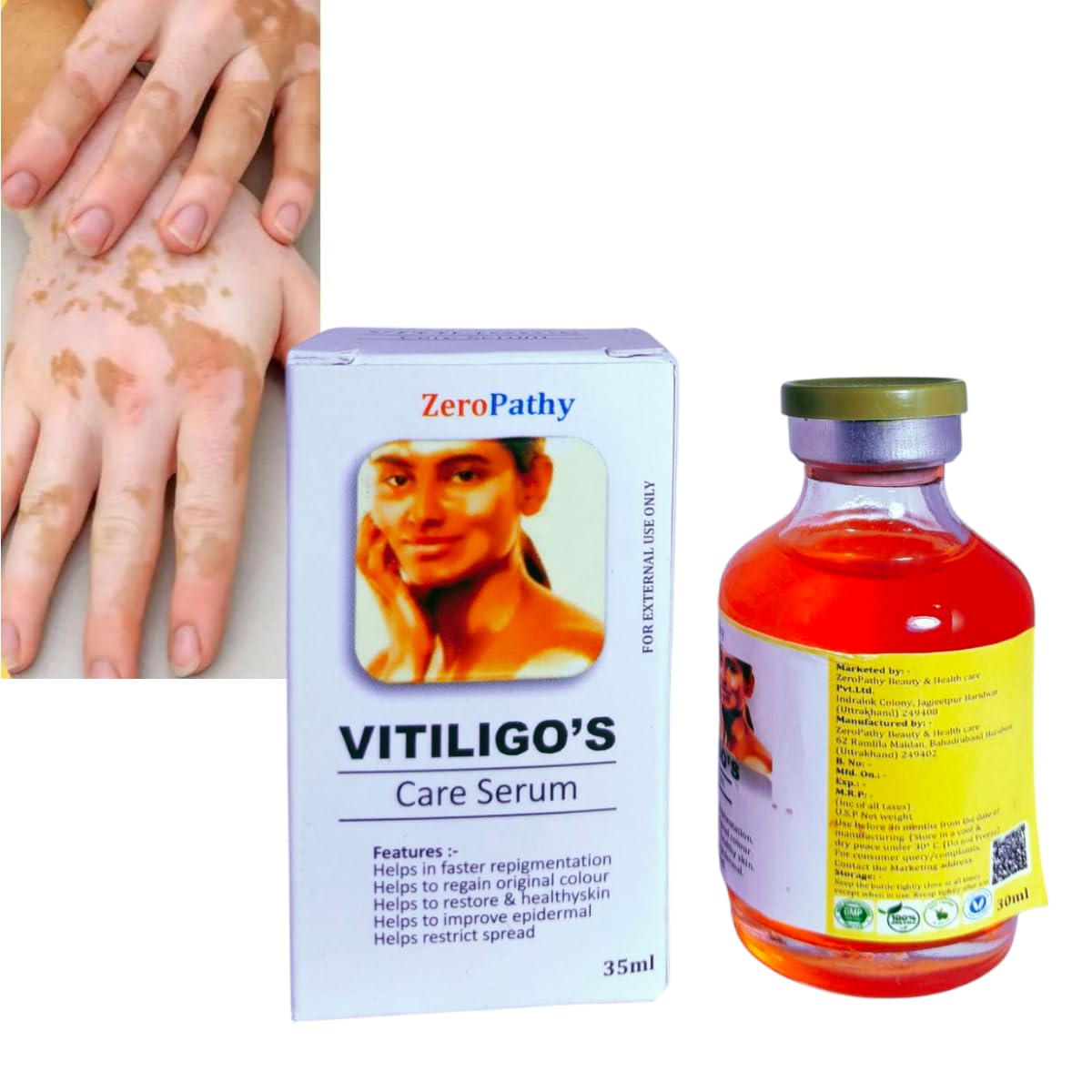 White Spot Ointment,Safed Daag Ke Liye,Natural Vitiligo with Turmeric, Aloe Vera & Ginseng, Designed to Restore Skin Pigmentation,Moisturing Disease Treatments Tag Remove Serum