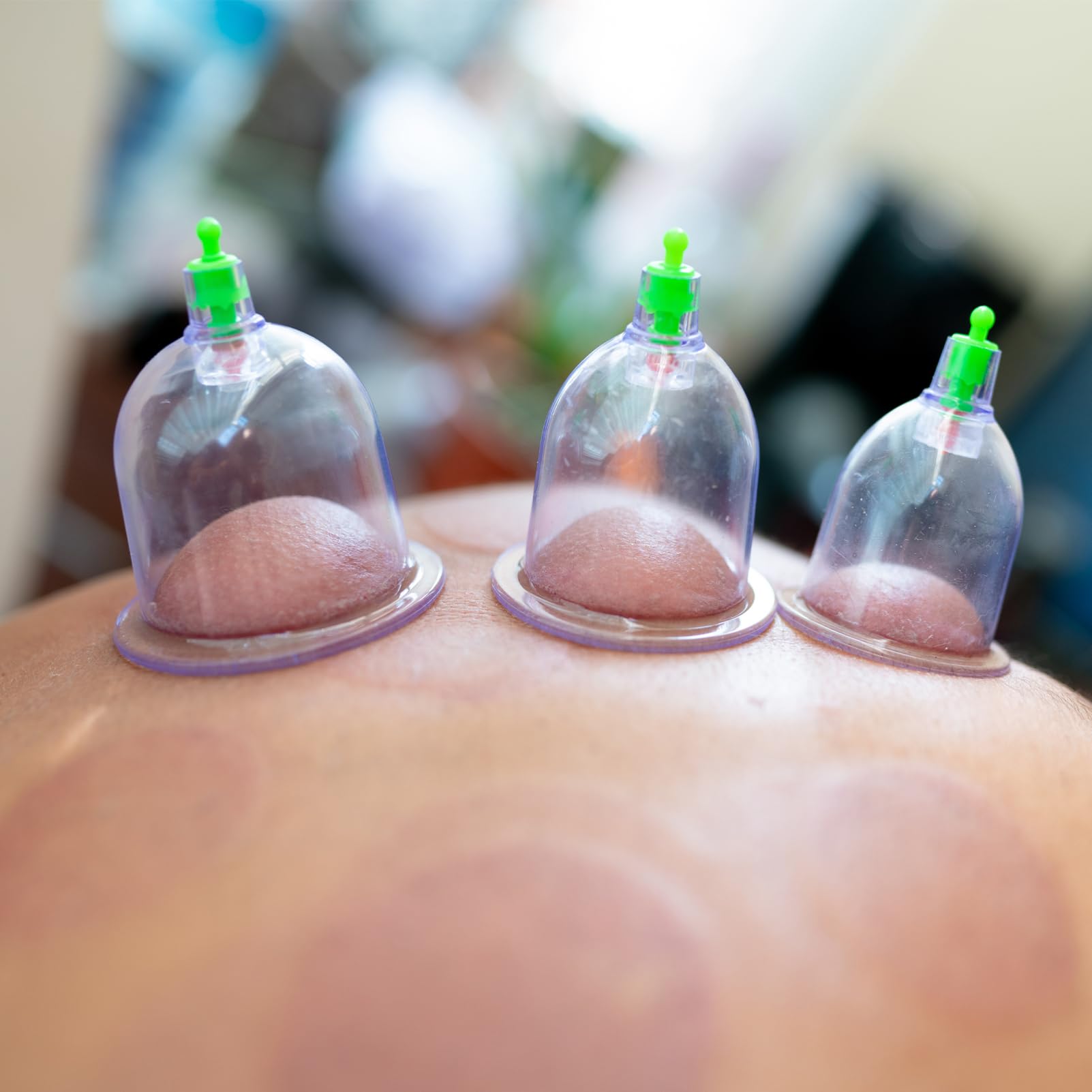 Kit de Ventouses à Vide pour Massage à Domicile, Accessoire de Massage en Plastique, Relaxation Musculaire et Ouverture Douce, 1 Set Fiable