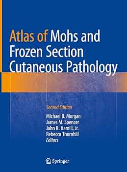 健康・医学 Atlas of Microsurgery of the Lateral S.. Atlas of Microsurgery of the Lateral Skull Base