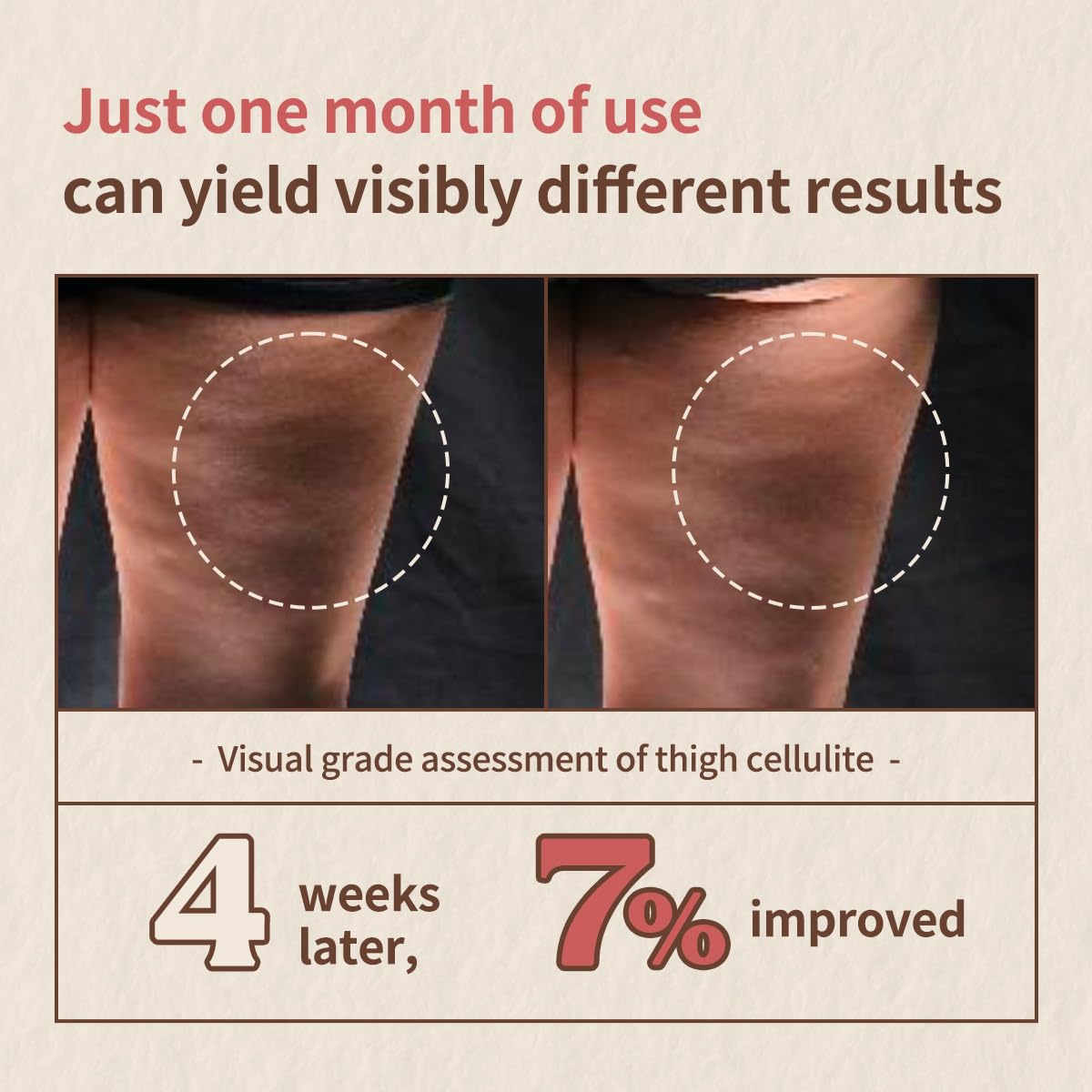 Aroma Nut Slim Fit Body Lotion-Korean Skin Care with 11 Aroma Essential Oils Extract, Anti-Cellutile Lotion, Natural Aroma Scent, Gluten-Free(200ml / 6.76 fl oz.) - Image 3