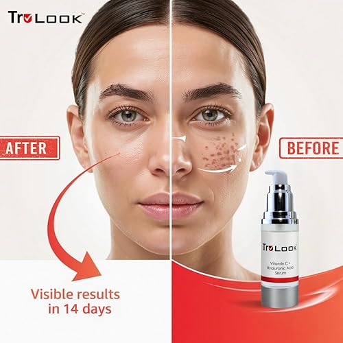 Miniatura 5 de TruLook Suero de vitamina C + ácido hialurónico, antienvejecimiento, antiarrugas, mejora las manchas oscuras, el tono y las líneas finas, fabricado