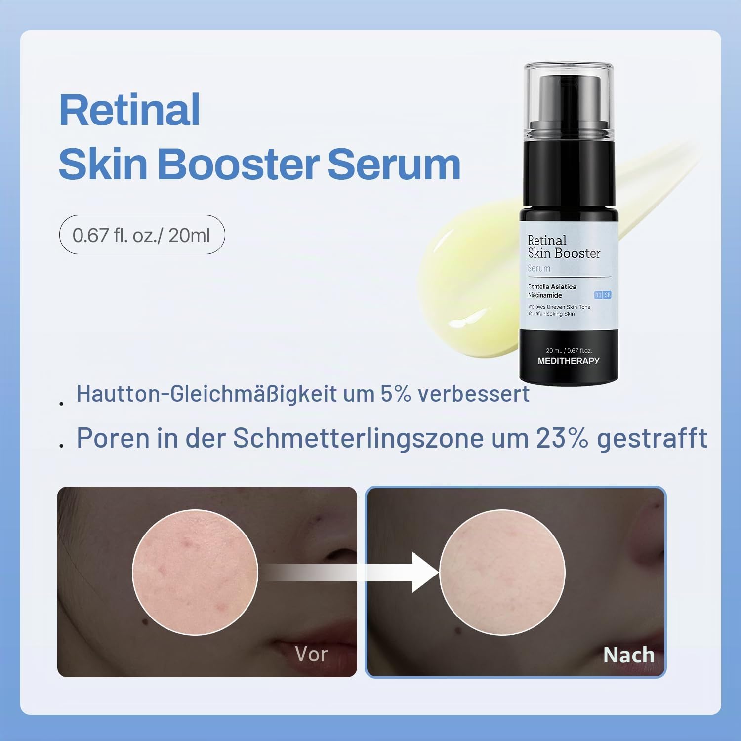 MEDITHERAPY Starter Set - Retinal Skin Booster Set + Getle Boost Kit (Retinal, Hyaluronic Acid & Squalane Moisturizer Set) - Tone Clarity & Beginner-Friendly Daily Routine