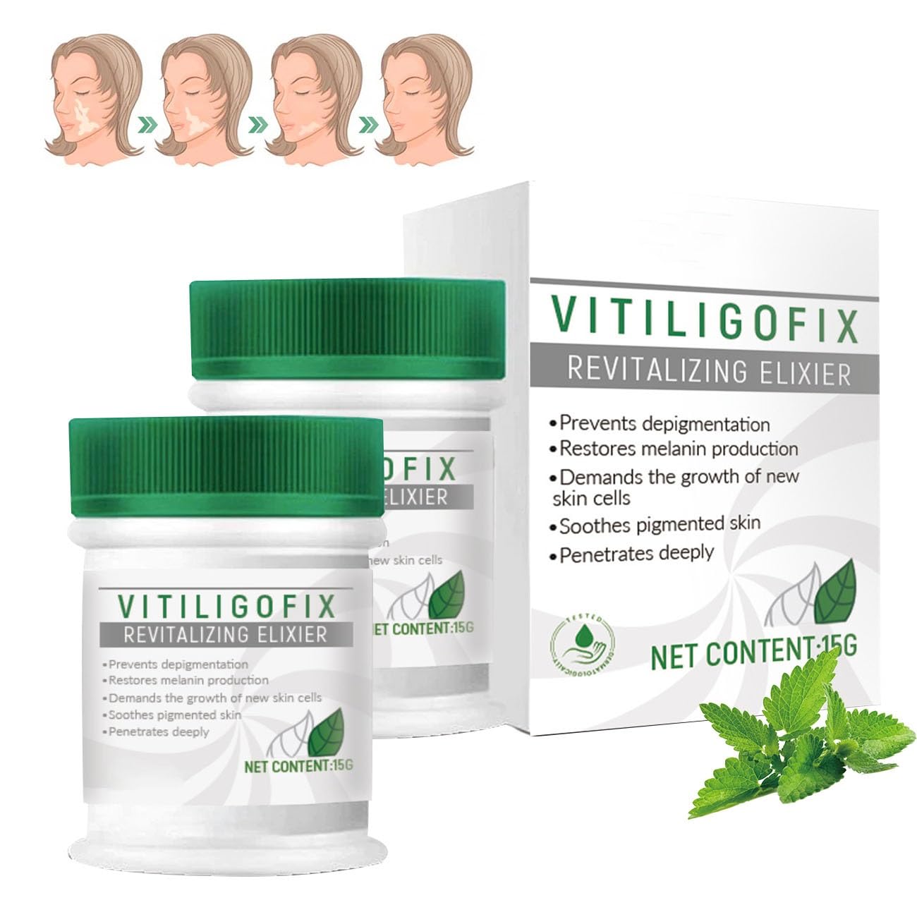Vitiligo Fix Revitalize Elixir，Vitiligo Treatment Cream