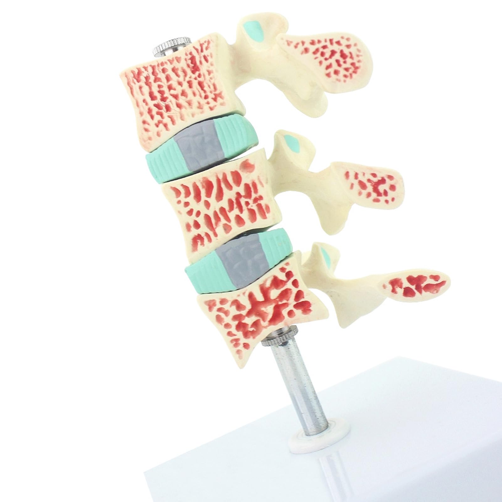 Model Osteoporozy Ludzkiej Lędźwiowych Trzysegmentowy Przekrojony Koloryzowane Krążki Międzypierścieniowe Regulowany Stojak Białe Podłoże PVC Dla Studentów Medycyny Ortopedów Fizjoterapeutów