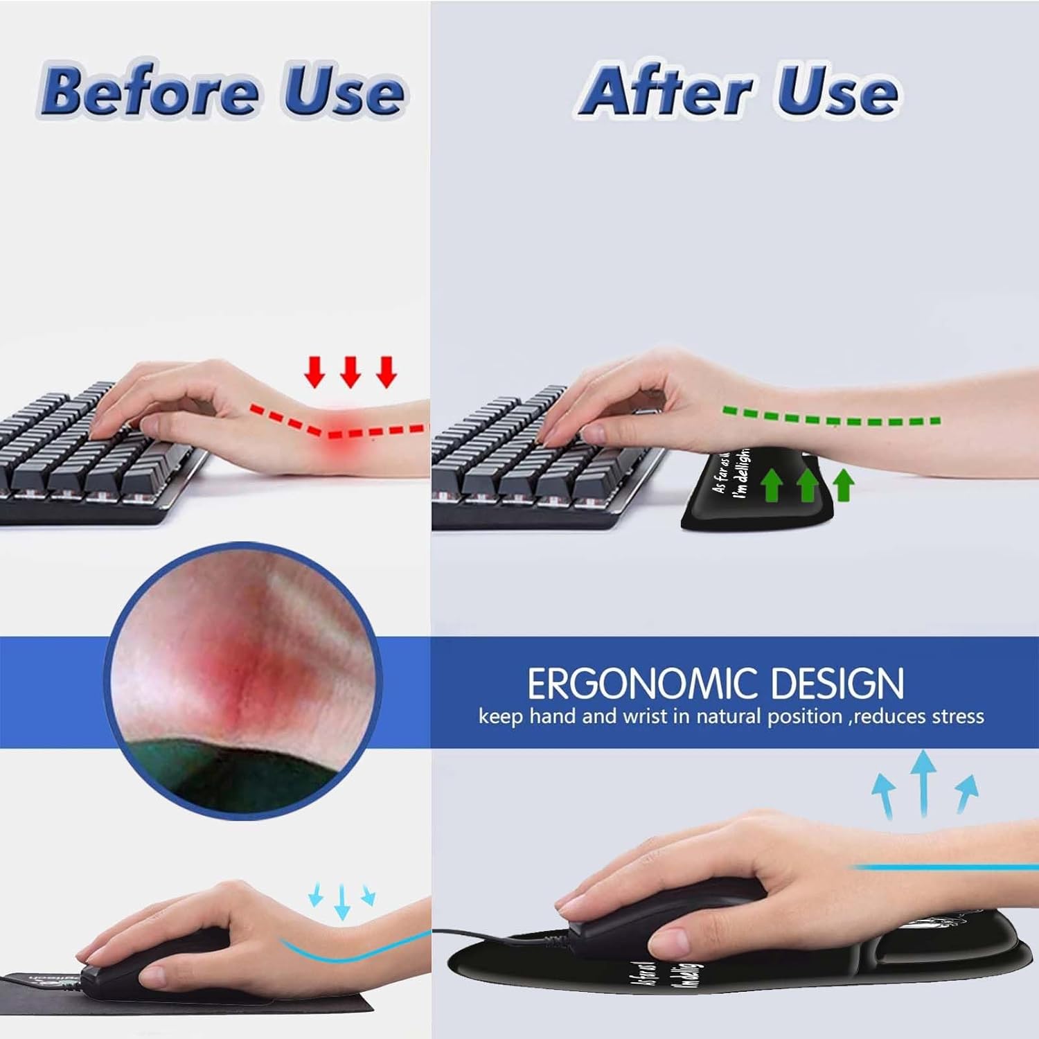 Ergonomic Gel Mouse Wrist Rest Pad and Keyboard Pad Set,Anti-Slip PU Bottom Easy Typing and Relieve Wrist Pain with Cute Coaster Set (3-Black Background Skull Skeleton)