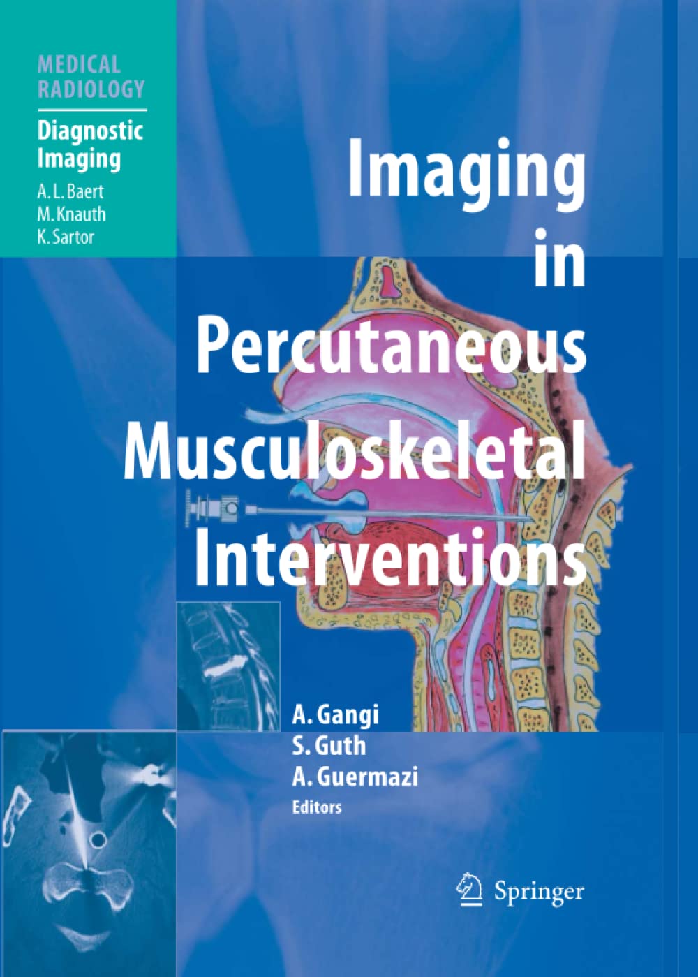 Imaging in Percutaneous Musculoskeletal Interventions