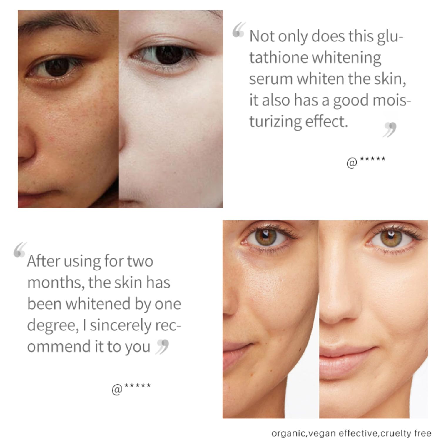 Glutathione Niacinamide Serum for Face  Hydrating & Moisturizing Face Care  with Niacinamide & Aloe, Skin Lotion with Glutathione for Deep Skin  Nourishment and Dryness Relief: Buy Online at Best Price in