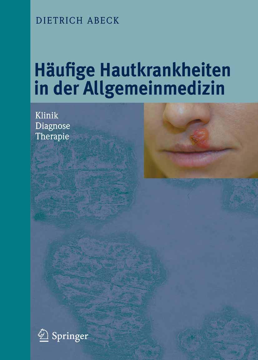 Häufige Hautkrankheiten in der Allgemeinmedizin: Klinik, Diagnose, Therapie