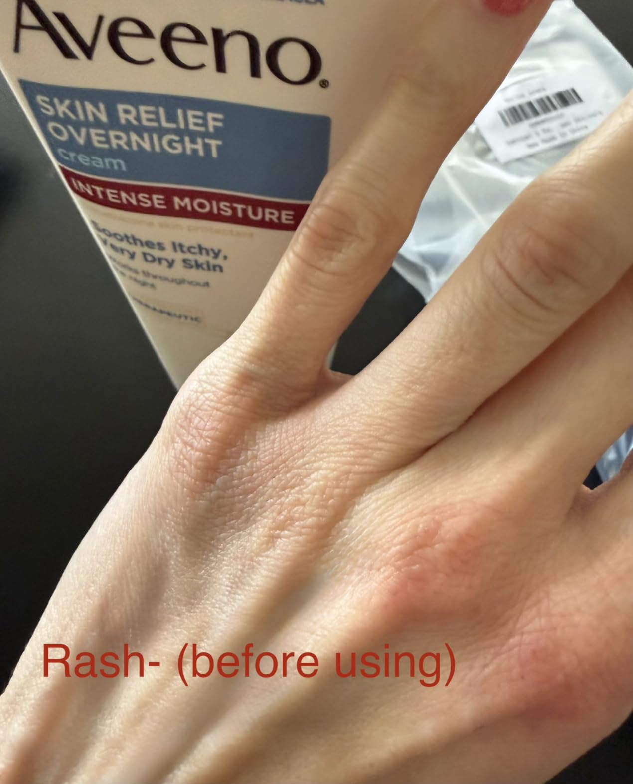 Kenvue Aveeno Skin Relief Overnight Intense Moisture Cream with Triple Oat Complex & Natural Shea Butter, Therapeutic Dimethicone Skin Protectant for Dry Itchy Skin Relief, Fragrance- & Steroid-Free, 7.3 oz