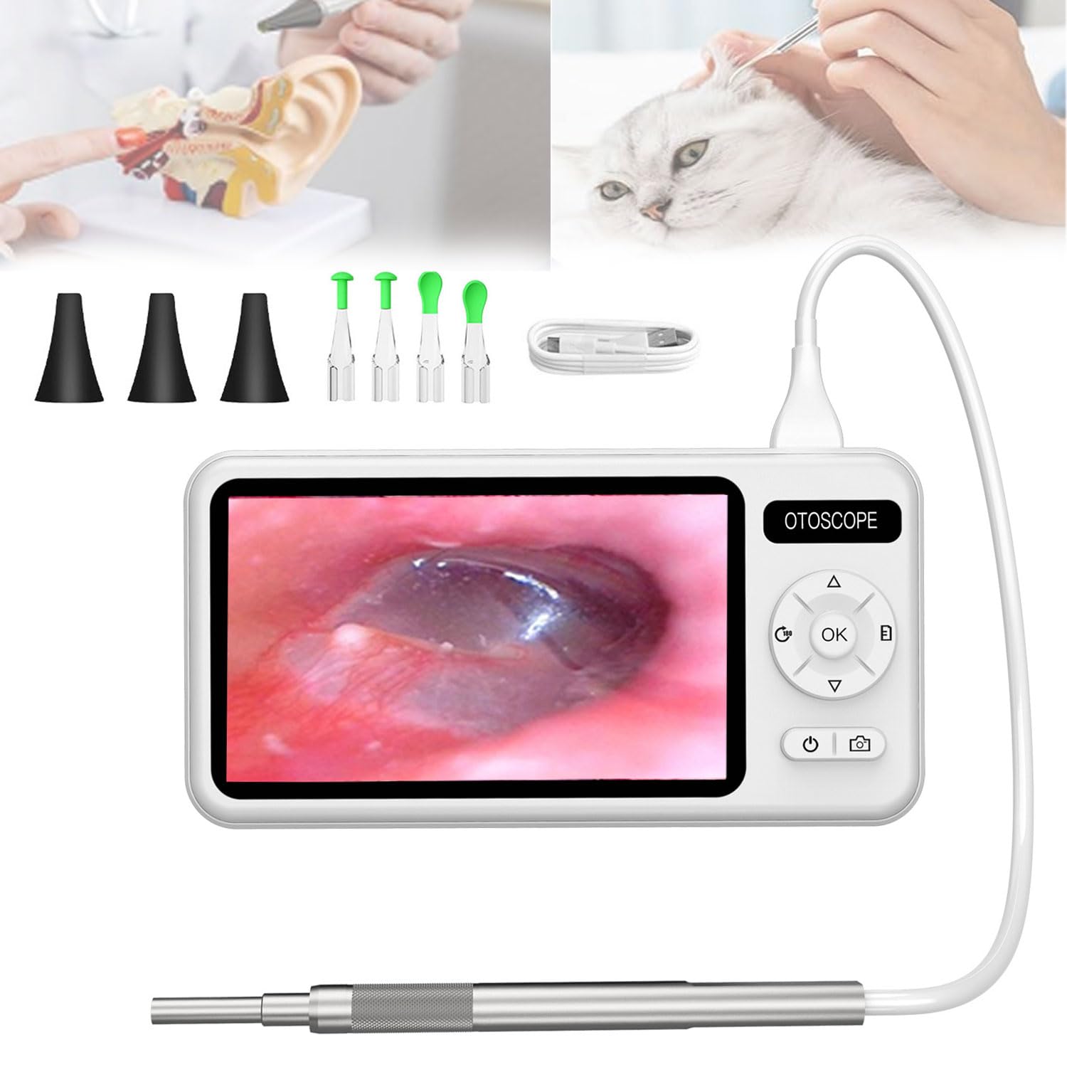 JOSBY Cámara de oído otoscopio de 5 Pulgadas, endoscopio de oído de 3,9 mm de diámetro, Herramienta de eliminación de Cera de oído con 6 Luces LED Ajustables y Kit de Limpieza de Puntas de oído