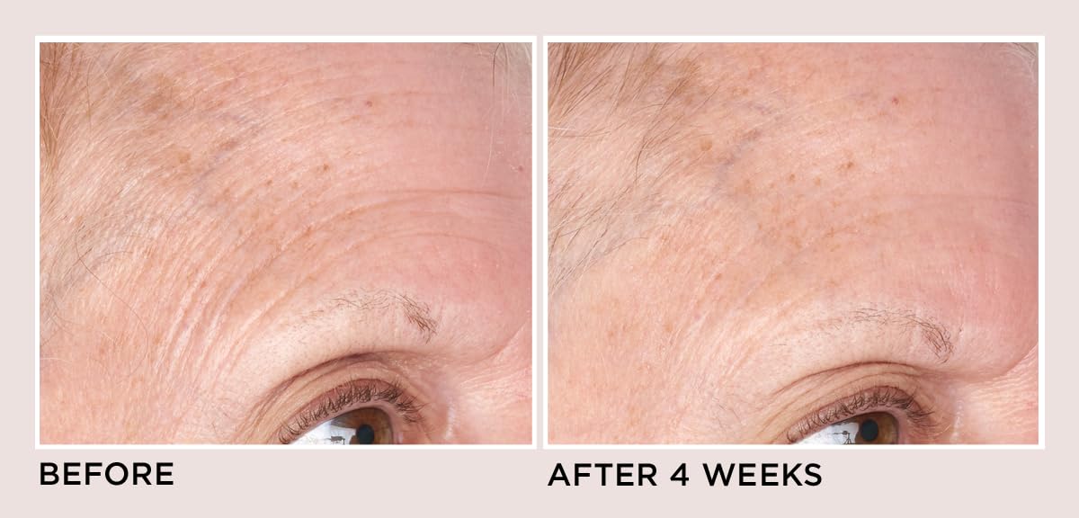 Perricone MD High Potency Classics: Face Finishing & Firming Moisturizer - Image 6