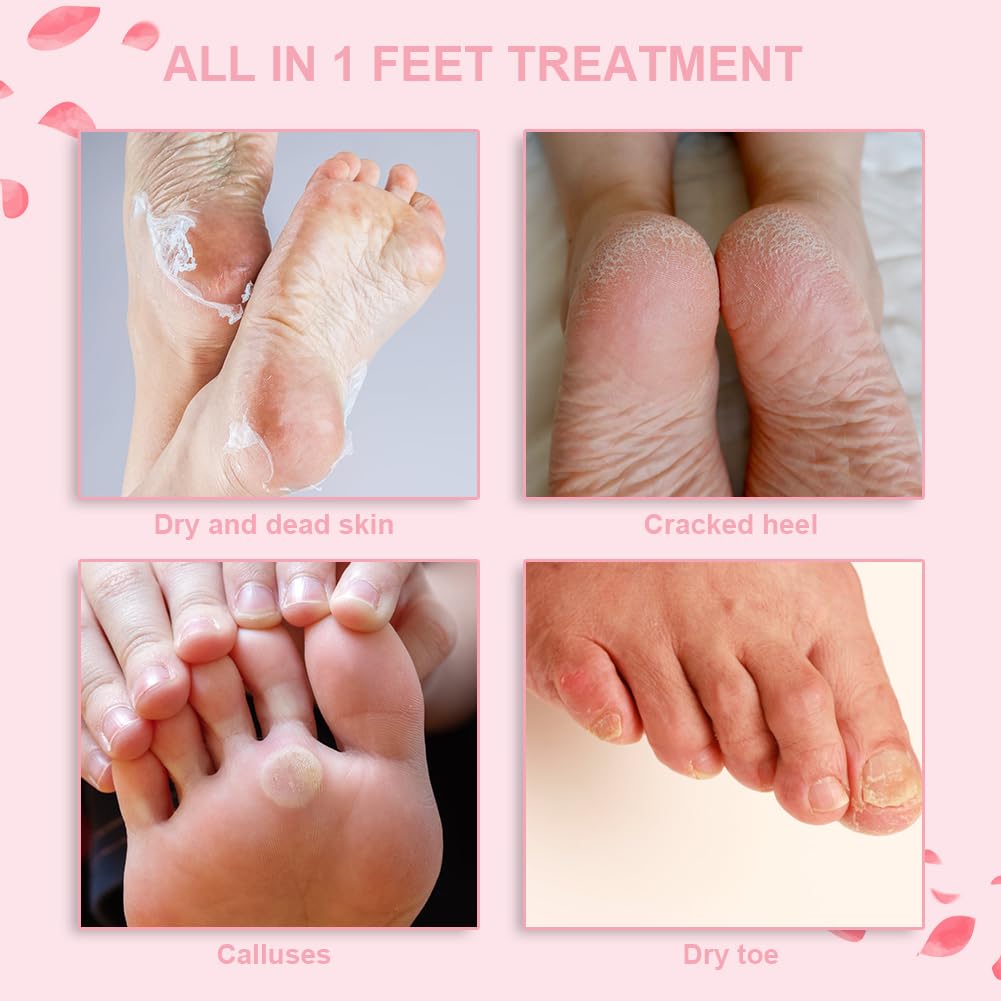 Masque Pieds Peeling Exfoliant, 4 Paires Masque Pieds Hydratant Exfoliant Saveur Rose, Masque Peeling pour les Pieds, Chaussette Exfoliante, pour Nourrissant Callosités, Crevasses et Pieds Secs