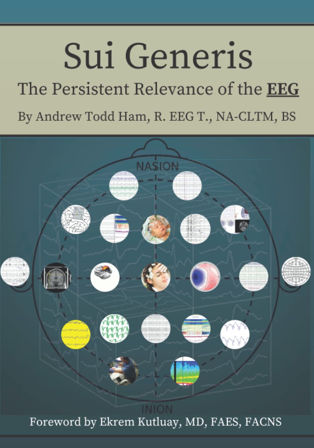 Sui Generis: The Persistent Relevance of the EEG