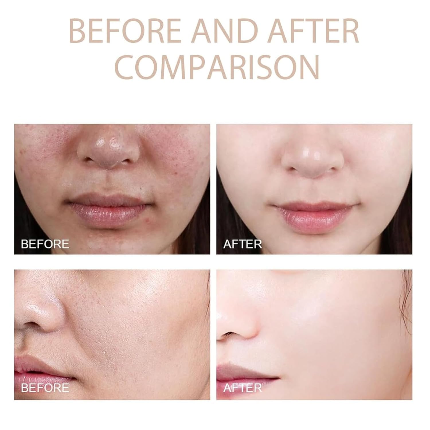 2PCS Purifying Exfoliating Gel,Purifying Exfoliating Moisturizing Gel,Suitable for face and body use ﻿ - Image 4