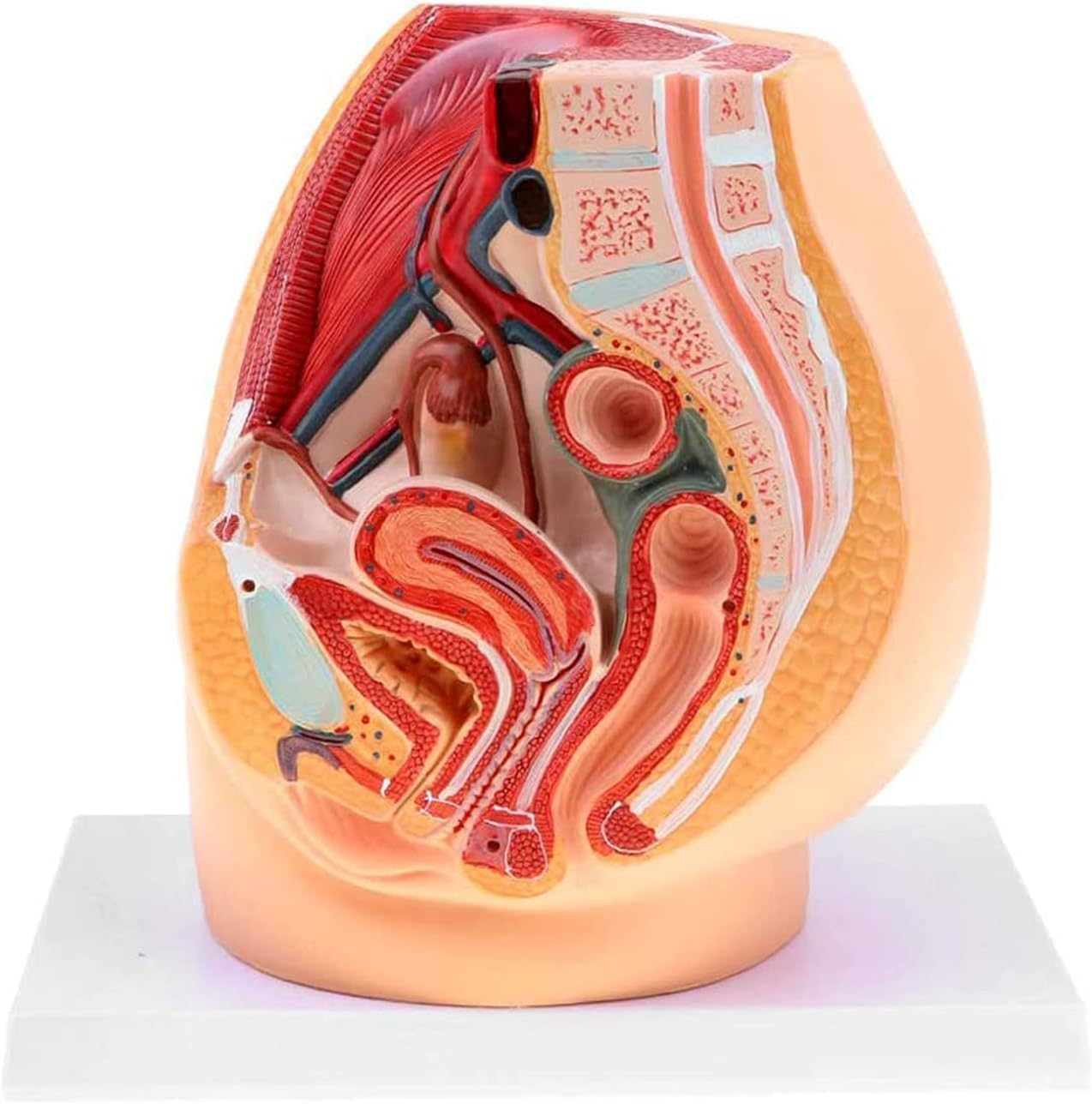 Model Anatomiczny Miednicy żeńskiej, Przekrój Strzałkowy Pośrodkowy, Ginekologiczne Zapalenie Gruczołu Krokowego Z Więzadłami, Naczyniami, Nerwami, Dnem Miednicy I Narządami, Do Szkoleń Med