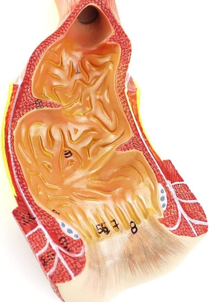 CHROX Modelo De Anatomía Anal Humana En PVC, Modelo Colorrectal En PVC, Cirugía Colorrectal, Cirugía General, Manual De Formación Médica