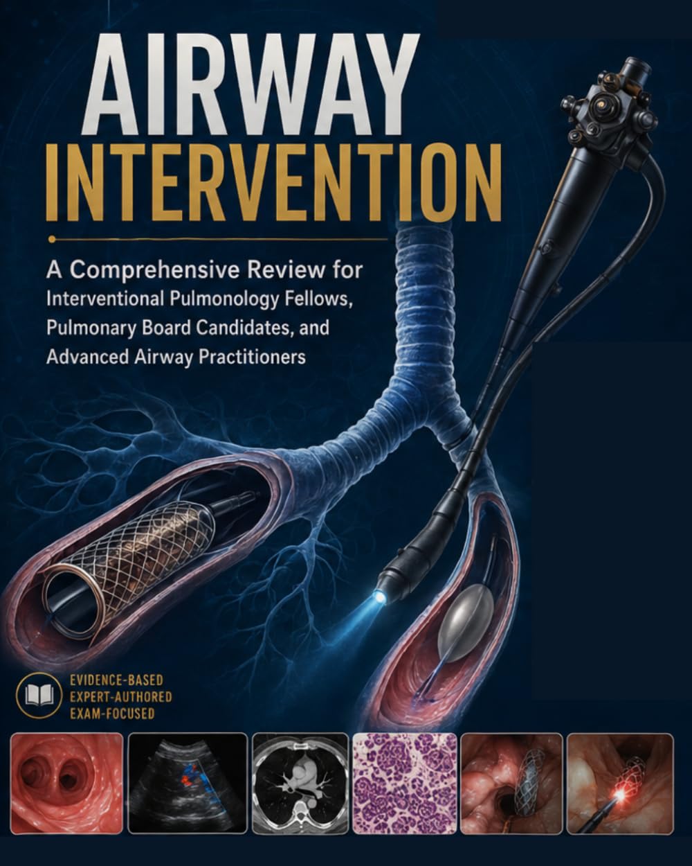 AIRWAY INTERVENTION: A Comprehensive Review for Interventional Pulmonology Fellows, Pulmonary Board Candidates, and Advanced Airway Practitioners