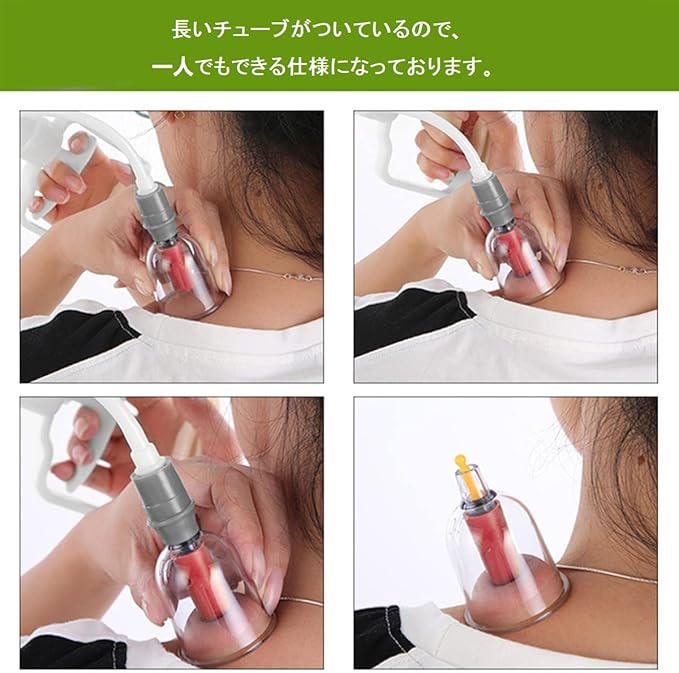 医工　【健医】カッピングα2 電動カッピング 健医志 電動ポンプ カッピングαミニ｜からだはうす｜検査・治療