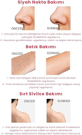 BabyPore Tonic 200 ML