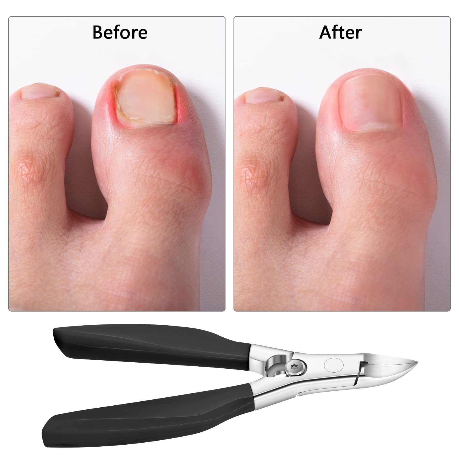 Zehennagelknipser für dicke Zehennägel, Edelstahl-Nagelhautschneider, Zehennagelzange mit scharfer gebogener Klinge für Fingernägel und Fußnägel (schwarz)