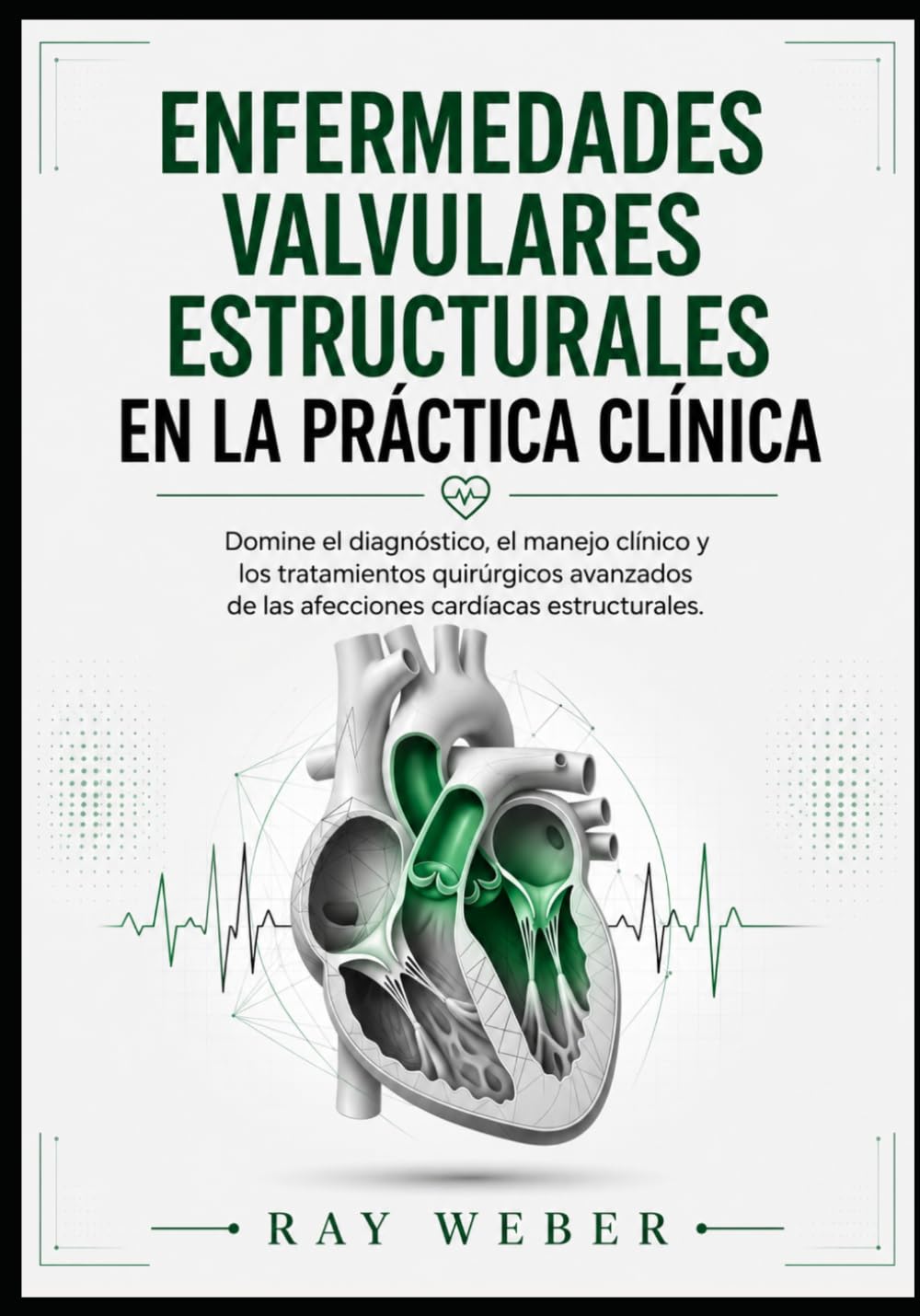Enfermedades valvulares estructurales en la práctica clínica: Domine el diagnóstico, el manejo clínico y los tratamientos quirúrgicos avanzados de las ... Protege tu corazón. Vive más tiempo.)