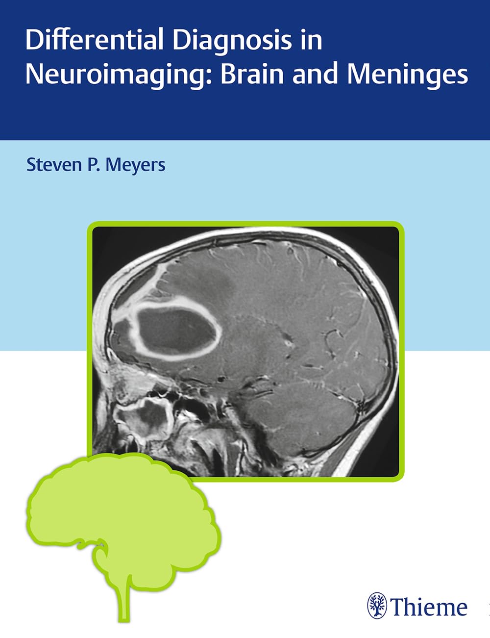 Buy Differential Diagnosis in Neuroimaging: Brain and Meninges — BookShops.in
