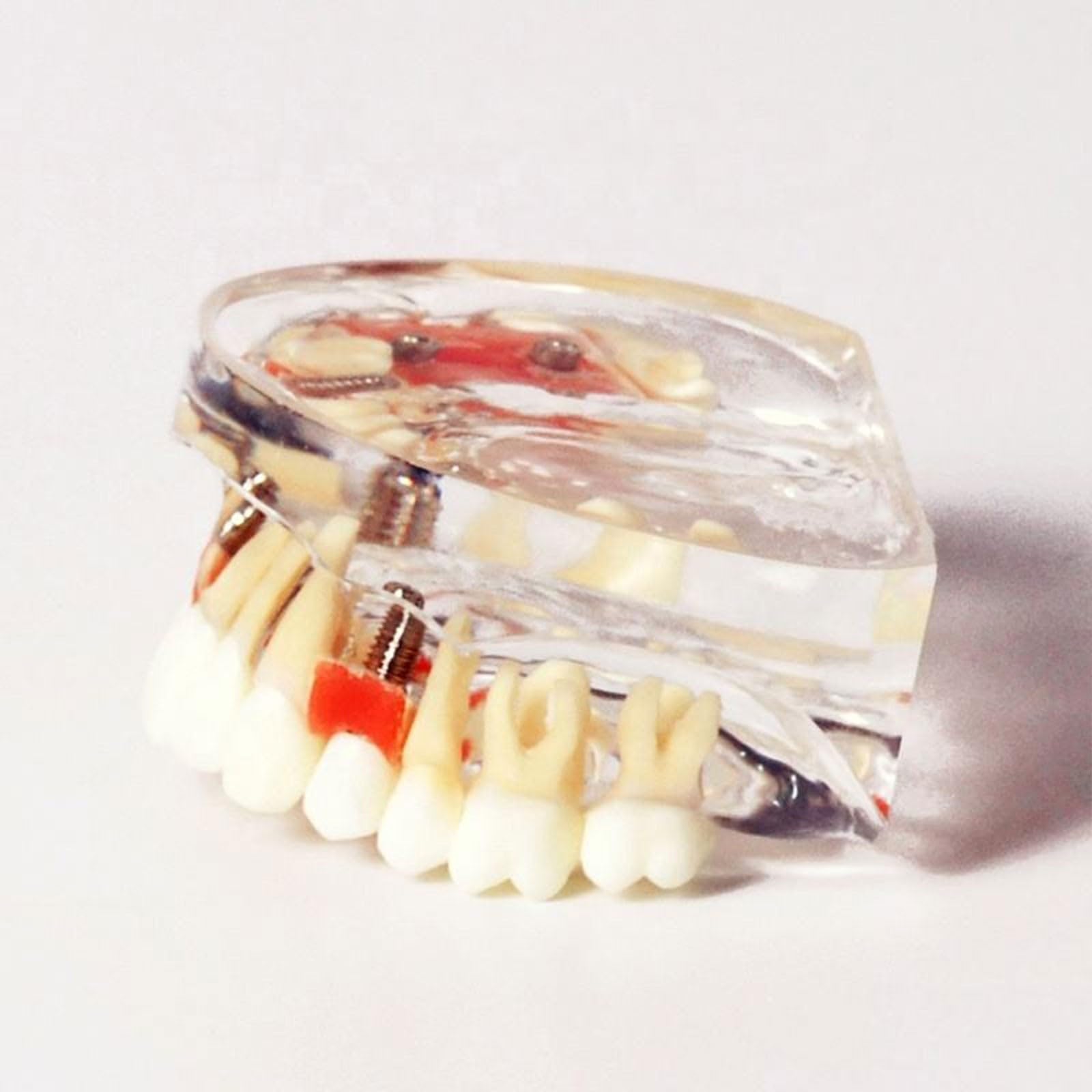Modello di dente per restauro implantare, Dente Morbido e Bendable Modello dentali superiori con 4 denti superiori, dimostrazione con visione trasparente per studenti di odontoiatria e formazion