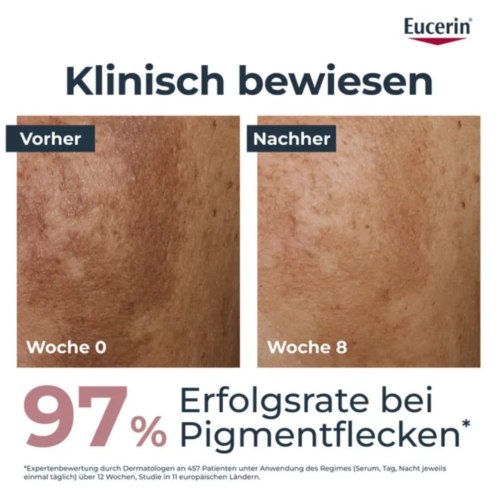 Eucerin Anti-Pigment Dual Serum, 30 ml Rozwiązanie | Widocznie redukuje plamy pigmentacyjne, nadaje skórze równomierną cerę, z tiiamidolem i kwasem hialuronowym