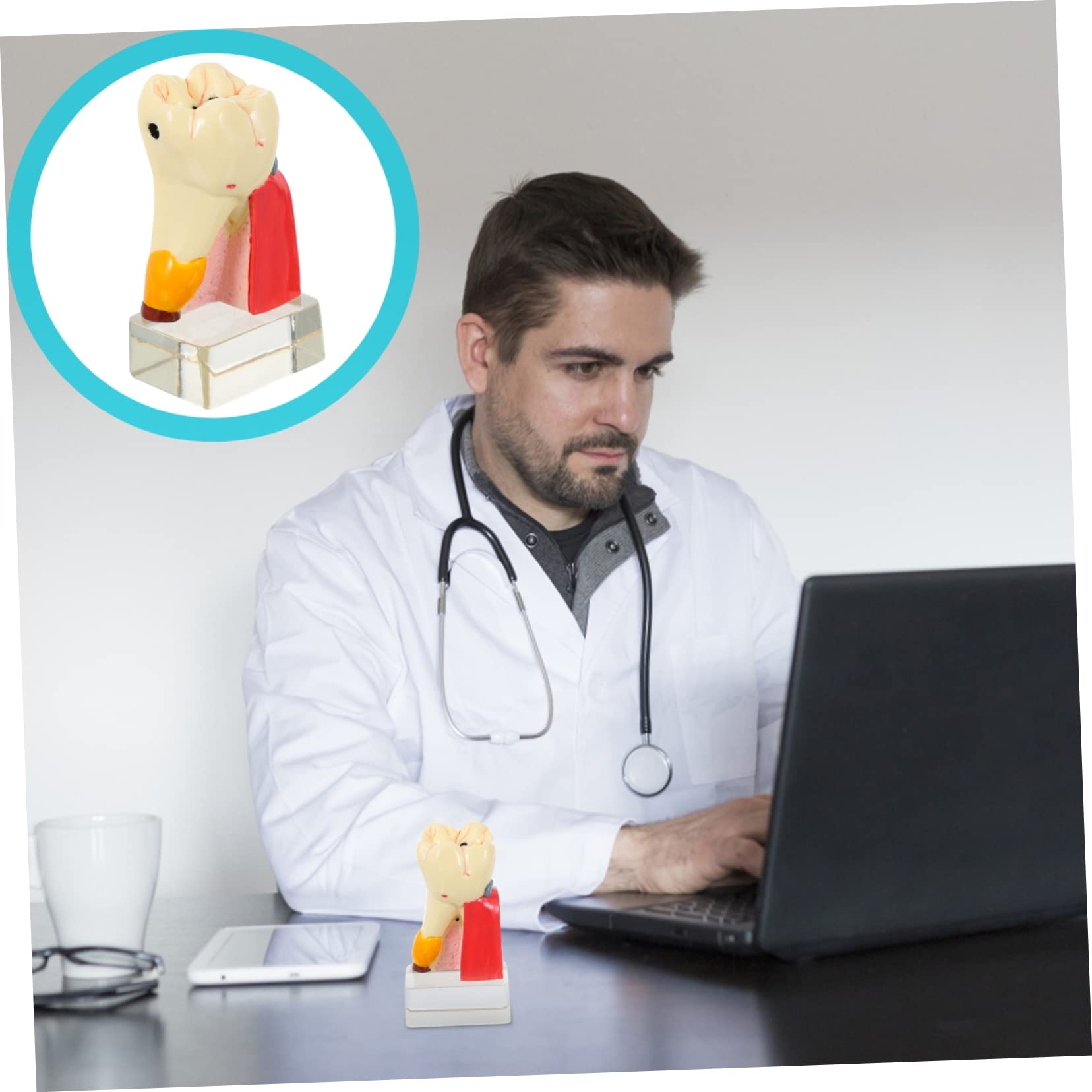 Modello di Carie Dentale in Resina Beige Leggero per Dimostrazione | Strumento Didattico Odontoiatrico, Modello Anatomico Denti per Studio, Materiale Resina