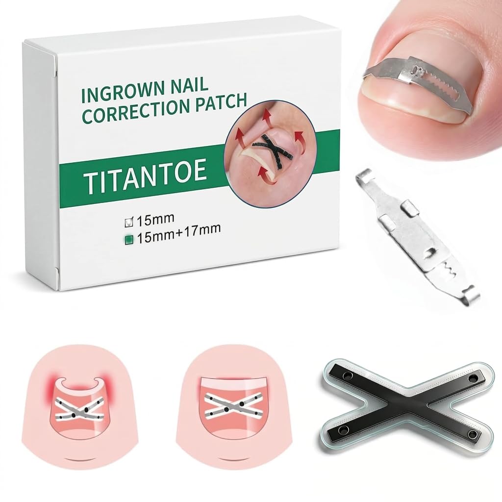 CHGRNLF Ingrown Toenail Treatment Kit - Pain Relief Strips