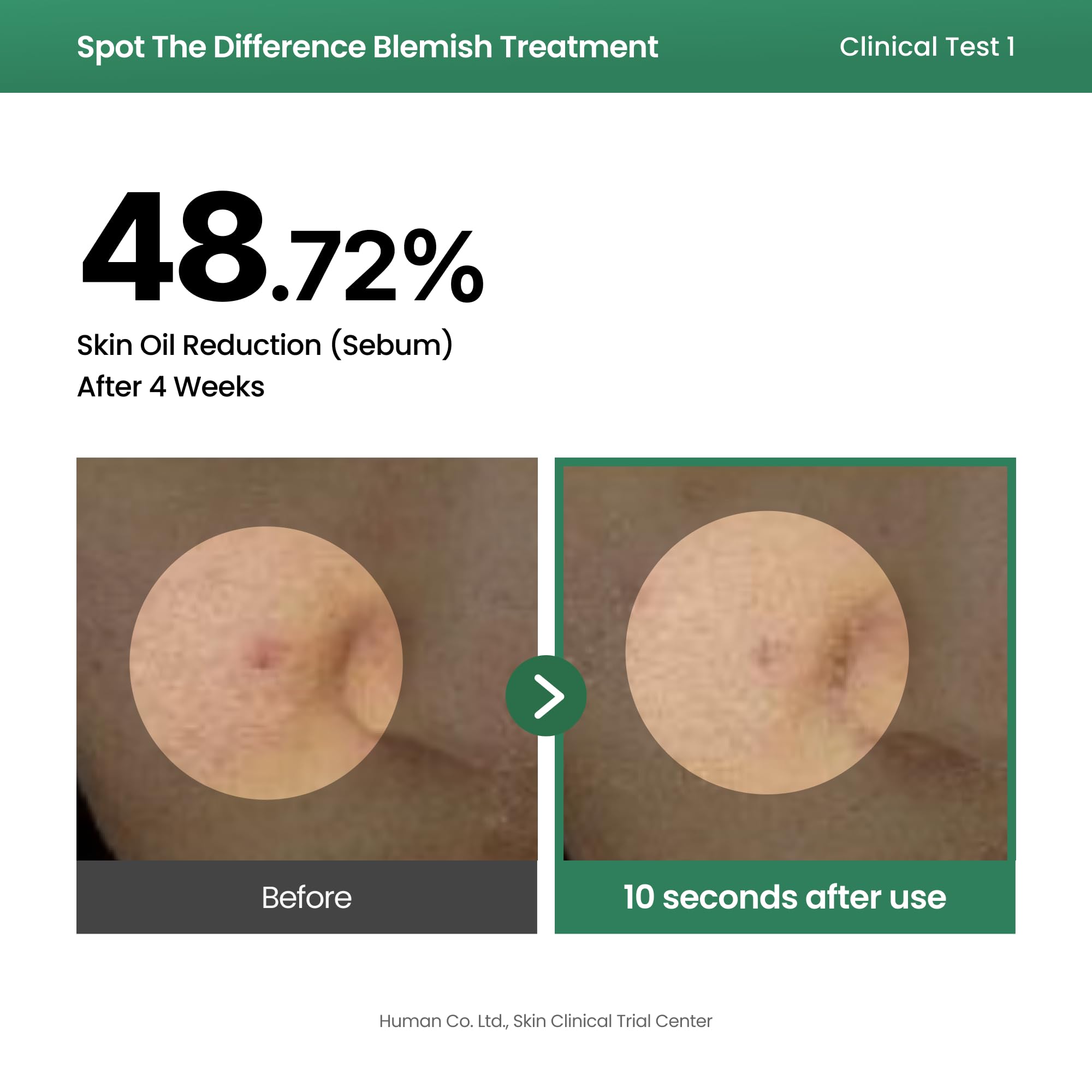 AXIS-Y Spot The Difference Blemish Treatment serum do skóry trądzikowej i skłonnej do niedoskonałości 15ml