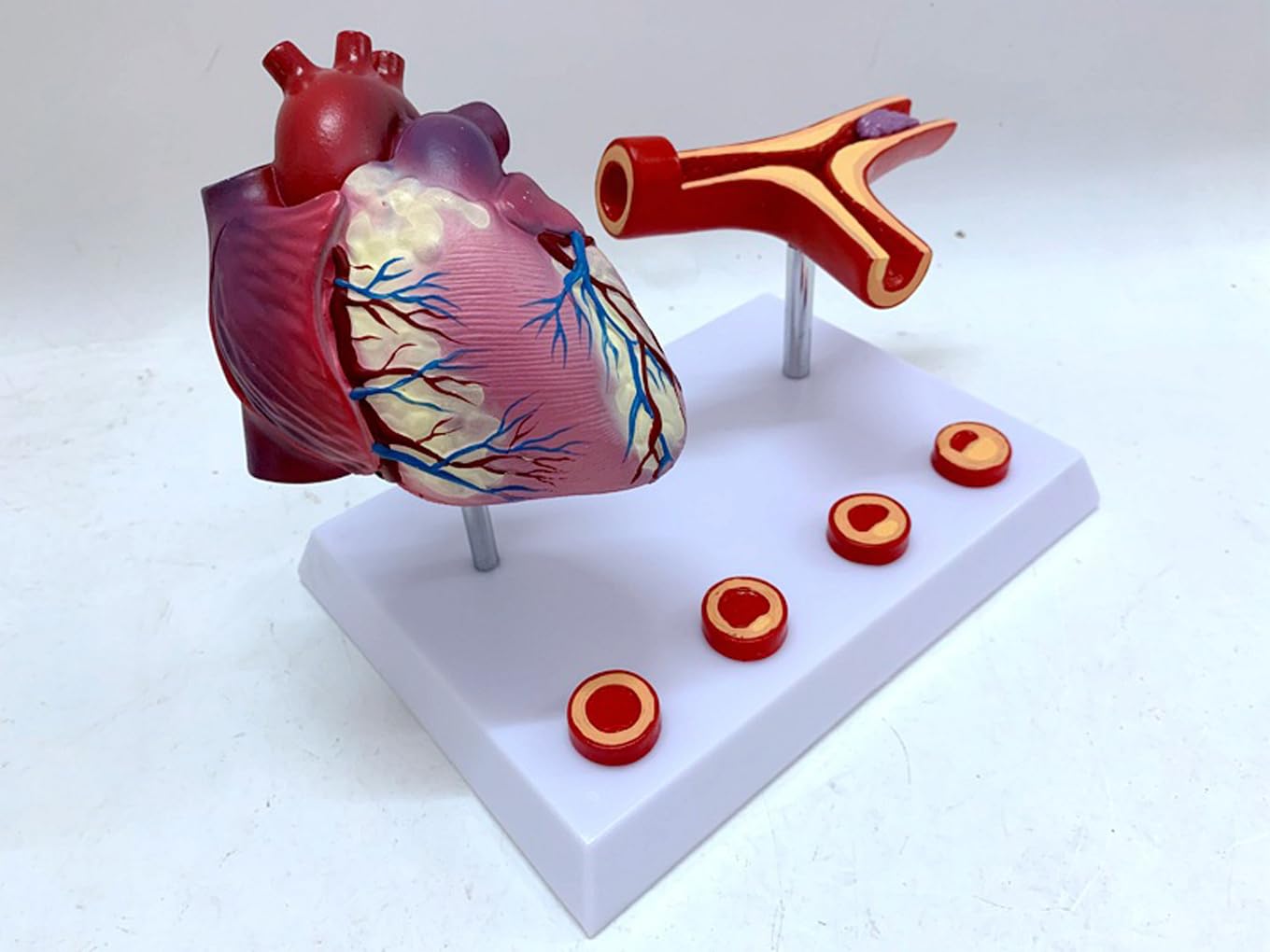 Narzędzia do nauki modelu, nauczanie anatomii serca serca pomostowanie tętnic wieńcowych model z blokadą tętnic i naczyń krwionośnych zakrzepica pomoce dydaktyczne