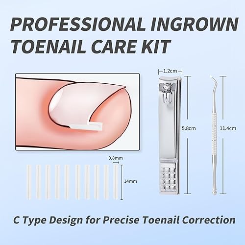Miniatura 7 de Paquete de 62 tiras correctoras para uñas encarnadas, herramienta de corrección profesional, alisador curvo para alivio de uñas encarnadas en casa