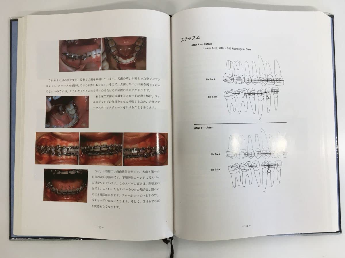 Amazon.co.jp: レベルアンカレッジシステム ー概念と治療法ー Terrell
