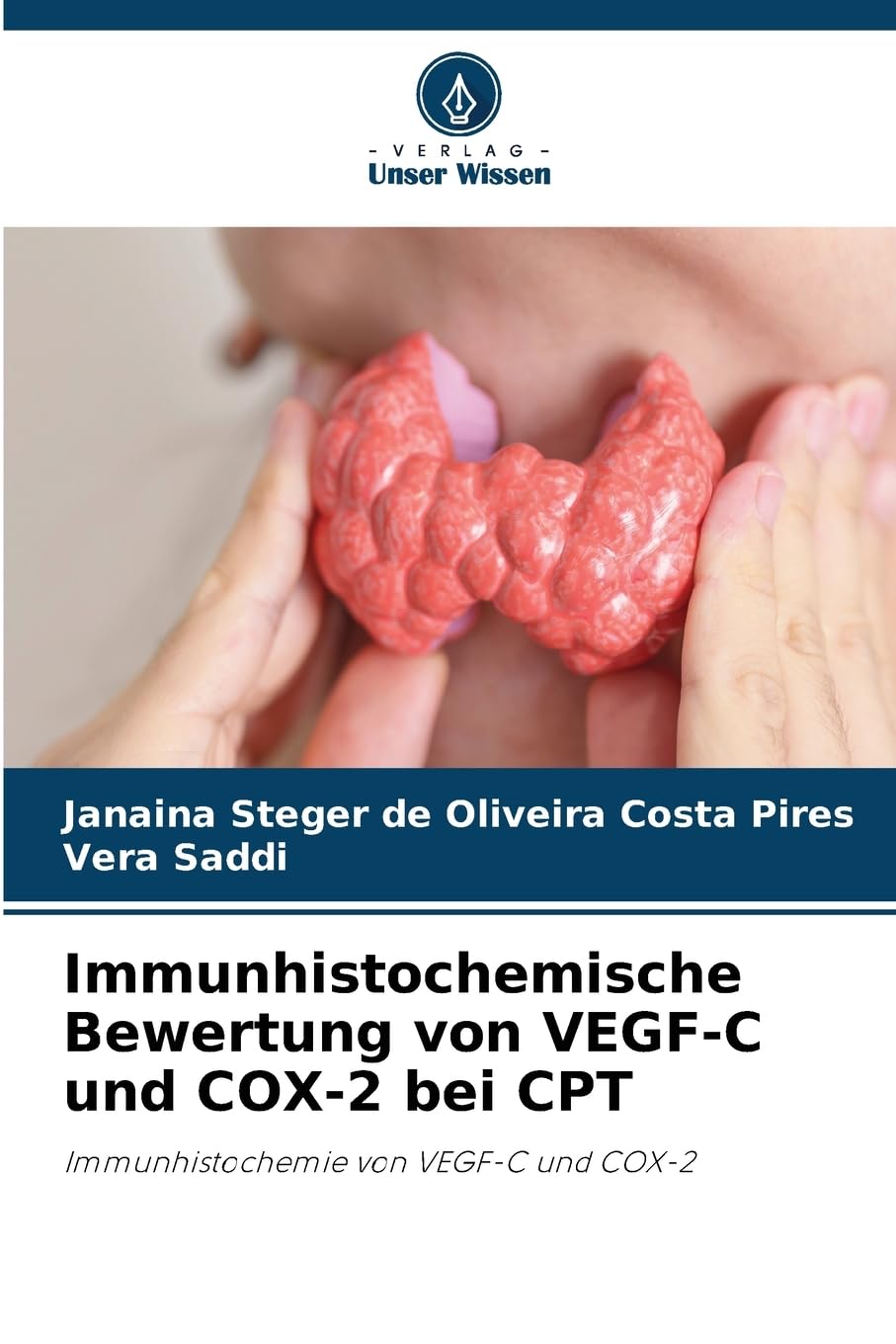 Immunhistochemische Bewertung von VEGF-C und COX-2 bei CPT: Immunhistochemie von VEGF-C und COX-2