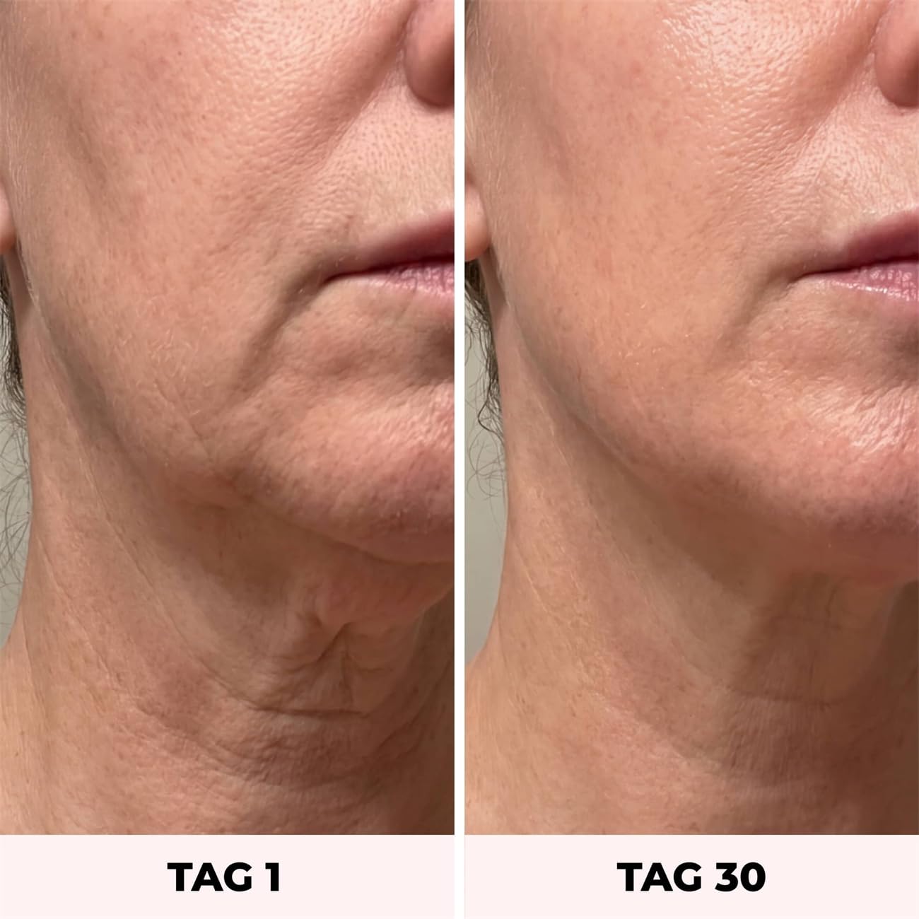 7-in-1 Gesichtsmassagegerät mit EMS & LED – Hautstraffung & Anti-Falten