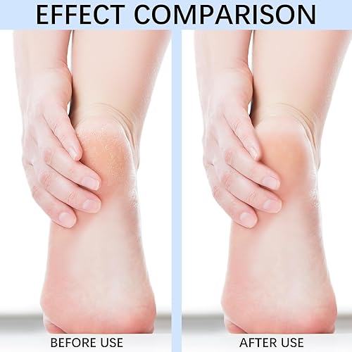 Miniatura 6 de C12rtive Brocas de disco de lijado para uñas, broca de carburo de diamante, brocas profesionales de manicura y pedicura para dar forma a las uñas,