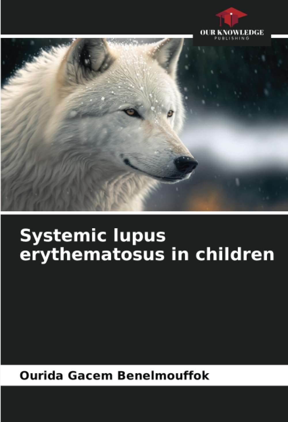 Systemic lupus erythematosus in children